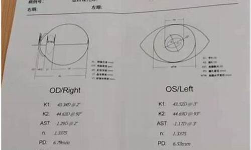 眼睛检查单上哪是散光_眼科检查报告单怎么