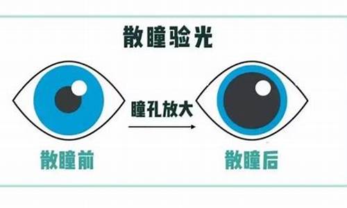 配眼镜散瞳_配镜散瞳和不散瞳有什么区别