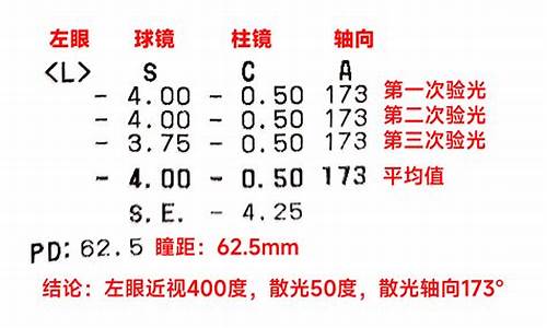 医学验光报告单怎么看_医学验光报告单怎么