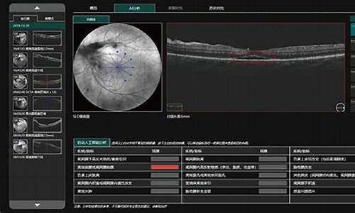 眼科oct检查结果怎么看_眼科oct检查结果怎么看图片