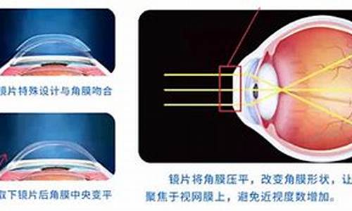 眼科疾病主要局限在眼部眼科医生_眼科疾病主要局限在眼部眼科医生看病