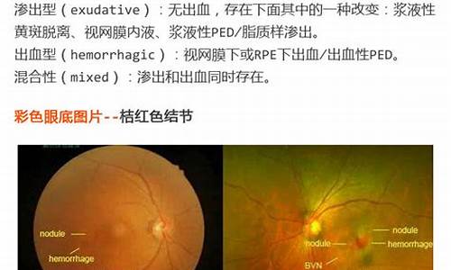 pcv眼科_pcv眼科是什么意思