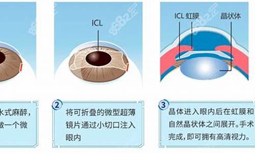 眼科学杂志是什么级别_眼科杂志排名前十名