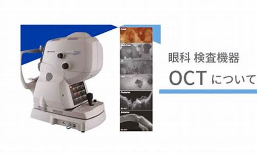 眼科oct检查什么意思_眼科oct检查图