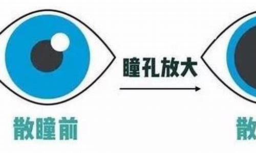 配眼镜散瞳_配镜散瞳和不散瞳有什么区别