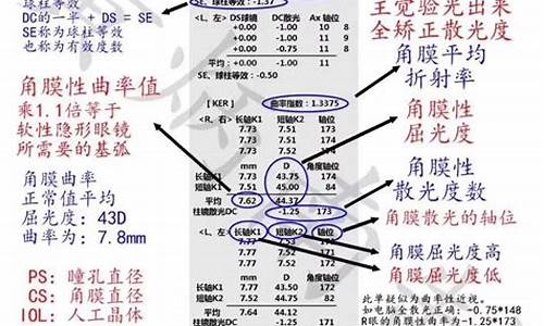 配眼镜度数怎么确定_配镜度数怎么看懂