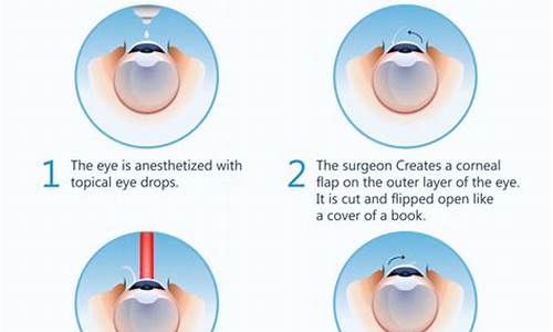 lasik深圳眼科医院_深圳眼科医院治疗近视怎么样