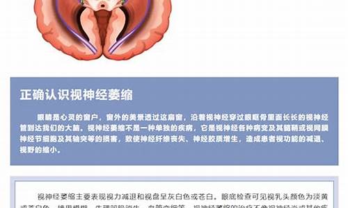 252医院眼科视神经萎缩_治疗视神经萎缩眼科医院