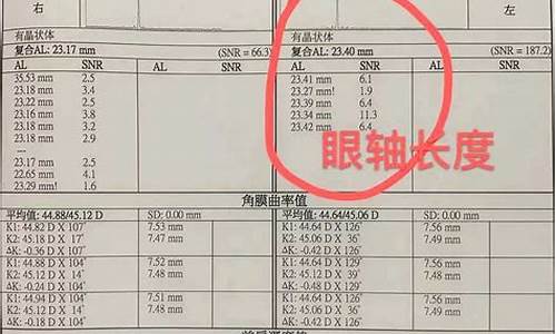 眼科检查数据怎么看se_眼科检查数据怎么看